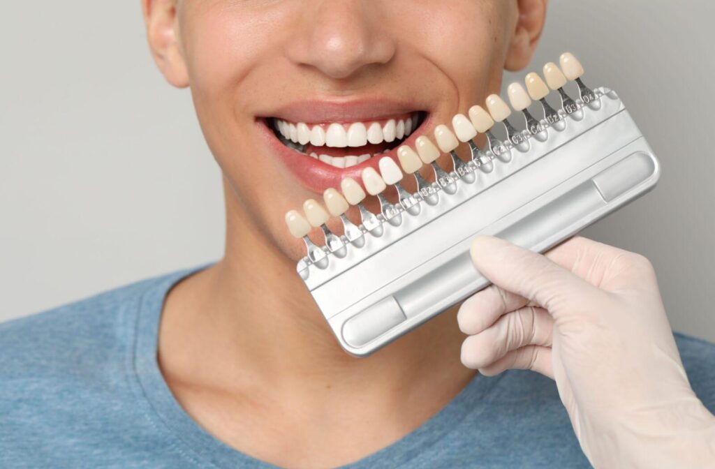 different veneer colour options being held up to a patients mouth